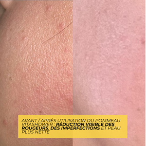 Pommeau de douche filtrant à la vitamine C doté de billes en céramique antibactériennes avec filtre intégré